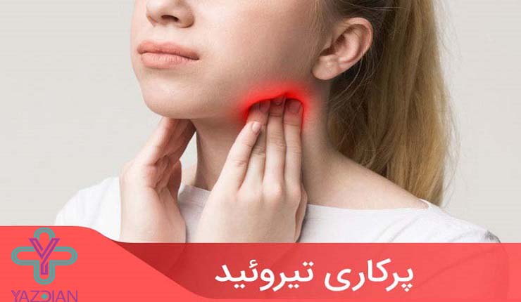 علائم تیروئید پرکار